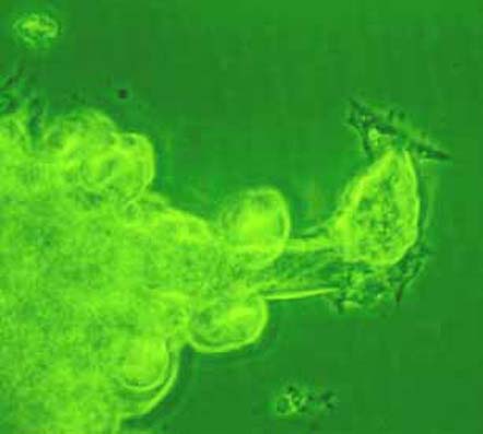 Earthworm cells in culture (phase contrast).